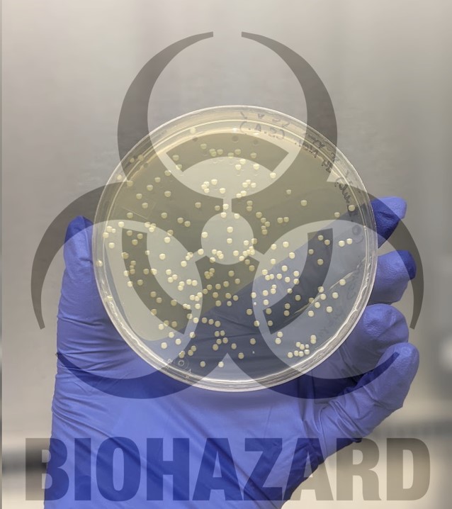 The core elements of biosafety and biosecurity in a microbiology laboratory handling regulated materials. Blog post by Amiirah Edoo
